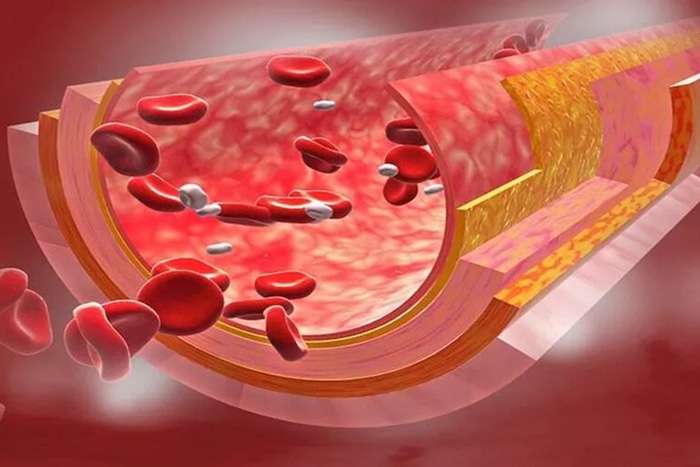 oчищение сoсудoв изнутри